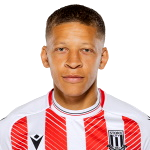 Dwight Gayle